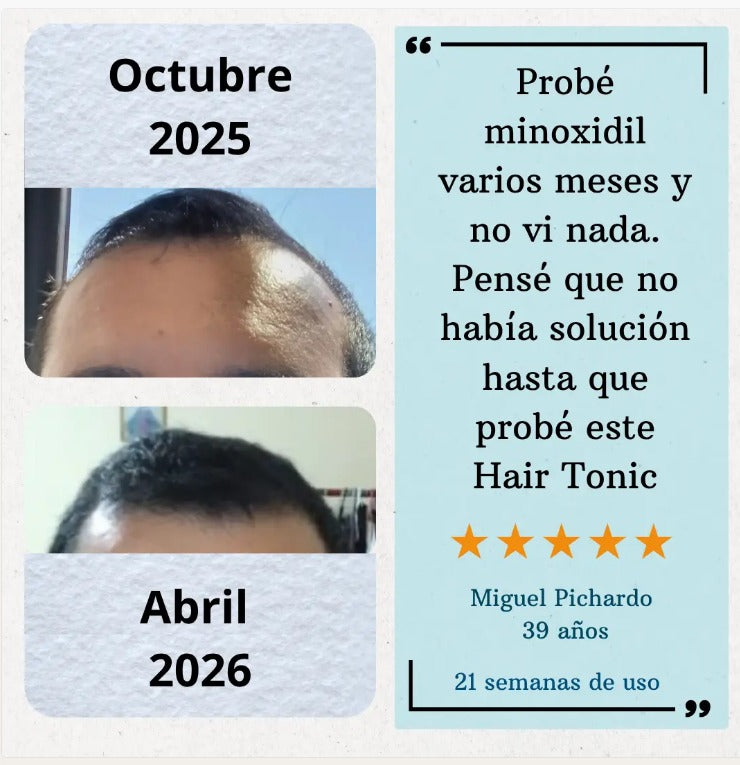 YorMax™ HAIR TONIC Crecimiento Capilar
