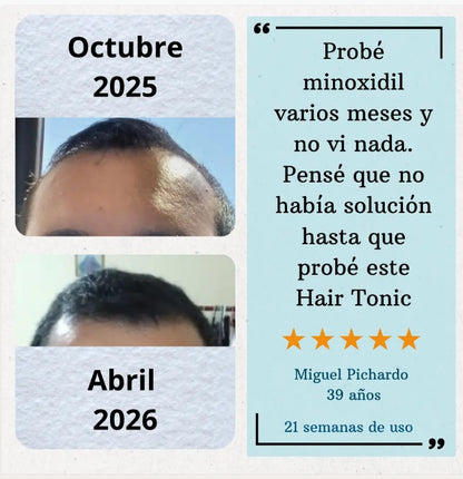 YorMax™ HAIR TONIC Crecimiento Capilar