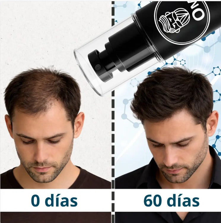 YorMax™ HAIR TONIC Crecimiento Capilar