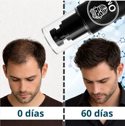 YorMax™ HAIR TONIC Crecimiento Capilar